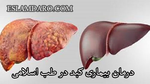 درمان بیماری کبد در طب اسلامی