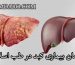 درمان بیماری کبد در طب اسلامی