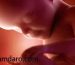 سقط کردن جنین یا زنده متولد شدن فرزند