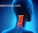 درمان دیستونی گردن (لرزش سر)
