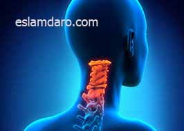 درمان دیستونی گردن (لرزش سر)