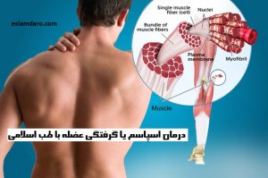 درمان اسپاسم یا گرفتگی عضلات