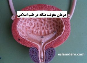 درمان عفونت مثانه