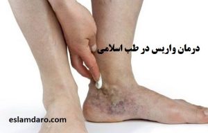 درمان واریس یصورت گیاهی و طبیعی
