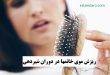 درمان ریزش موی خانمها در دوران شیردهی