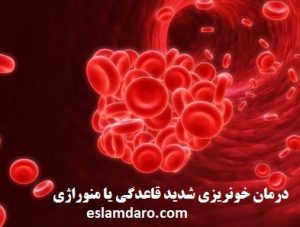 درمان خونریزی شدید قاعدگی یا منوراژی