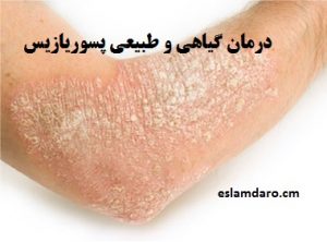 درمان گیاهی و طبیعی پسوریازیس