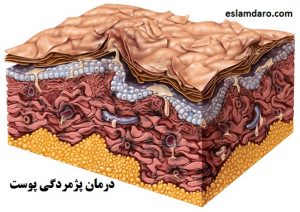 درمان پژمردگی پوست