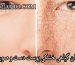 درمان گیاهی خشکی پوست دست و صورت