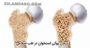 درمان پوکی استخوان در طب اسلامی