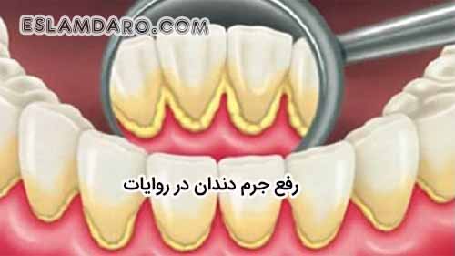 رفع جرم دندان بنا به روایات