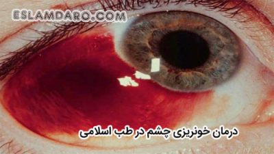 درمان خونریزی چشم در طب اسلامی