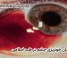درمان خونریزی چشم در طب اسلامی