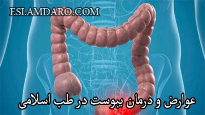 عوارض و درمان یبوست در طب اسلامی