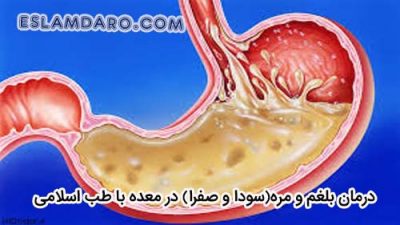 رفع بلغم و مره(سودا و صفرا) در معده