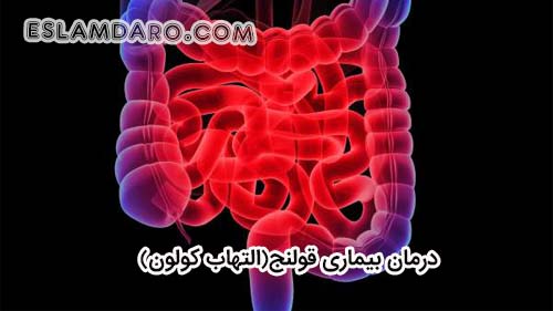 درمان بیماری قولنج (التهاب کولون) در طب اسلامی