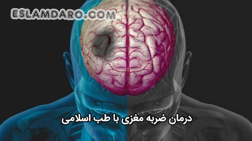 ضربه مغزی