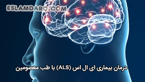 ای ال اس