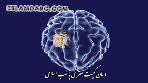 درمان کیست مغز
