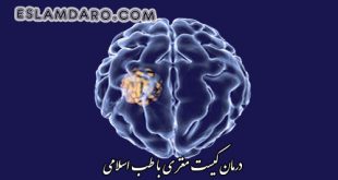 درمان کیست مغز