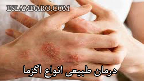 درمان طبیعی انواع اگزما