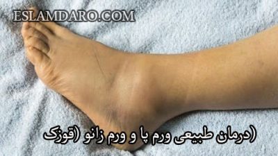 درمان طبیعی ورم پا و ورم زانو (قوزک)