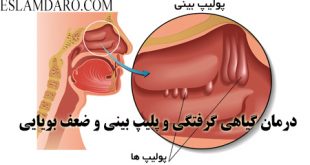 درمان گیاهی گرفتگی و پلیپ بینی و ضعف بویایی