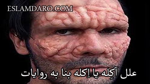 علل آکِله یا اِکله بنا به روایات
