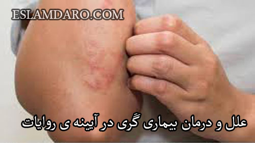 علل و درمان بیماری گَری در آیینه ی روایات